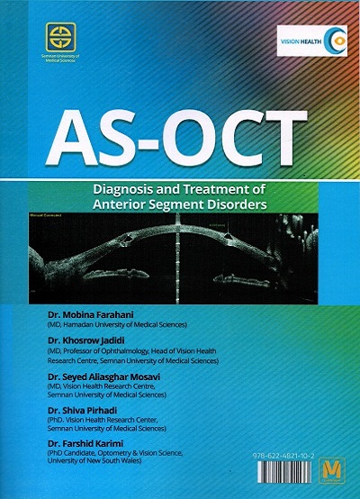 Diagnosis and Treatment of Anterior Segment Disorders