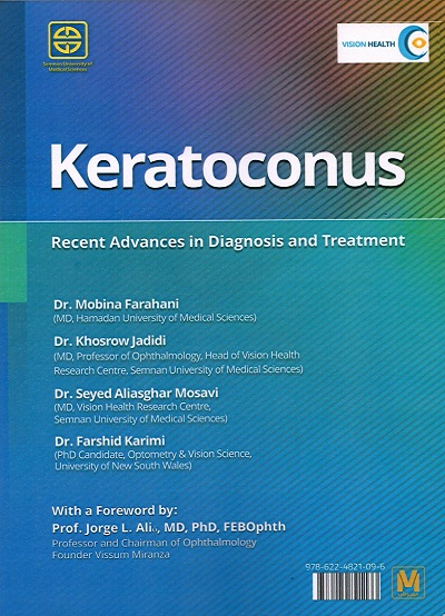 Keratoconus